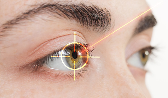 Laser Vision Consult and Follow up care